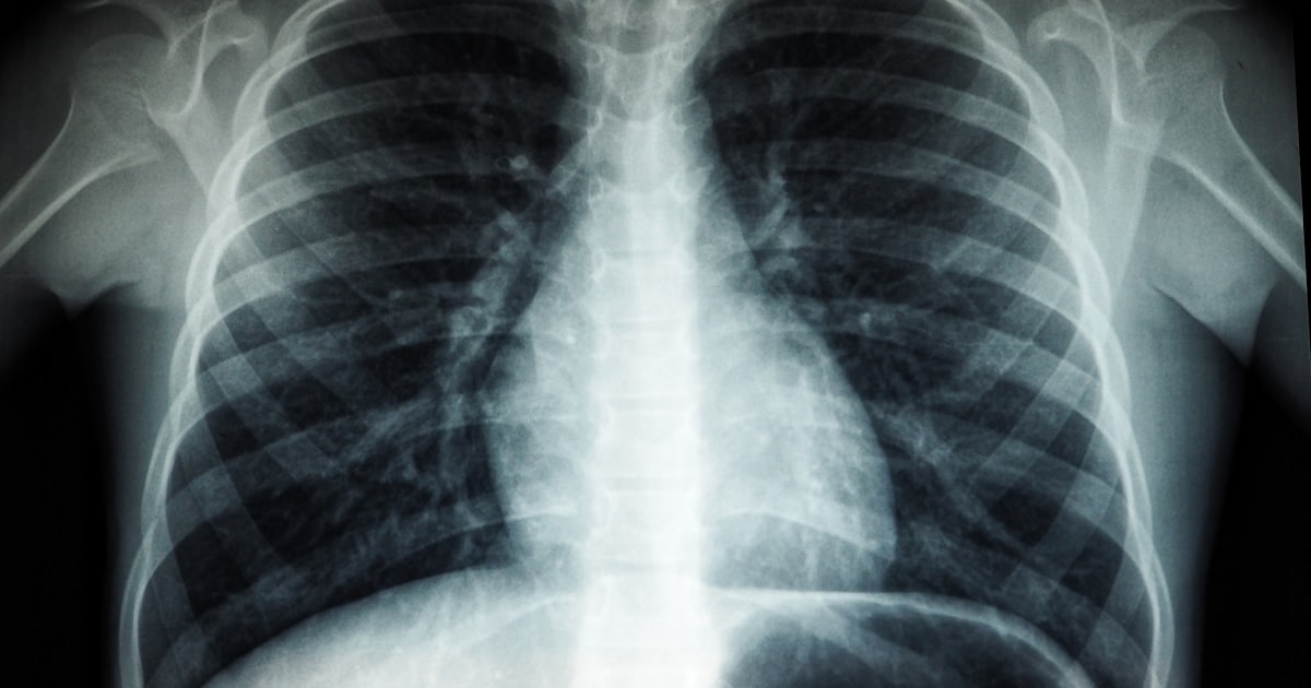 Medical AI Diagnostic Errors in Ohio: Your Rights When an Algorithm Misreads a Cleveland Patient